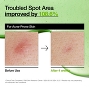 ANUA Azelaic Acid 10% Serum - Serum Anti-rojeces 30 ml