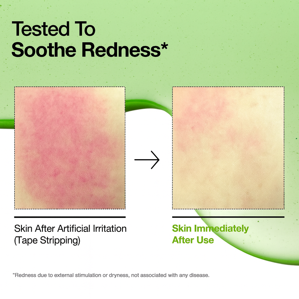 ANUA Azelaic Acid 10% Serum - Serum Anti-rojeces 30 ml