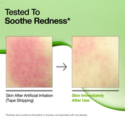 ANUA Azelaic Acid 10% Serum - Serum Anti-rojeces 30 ml