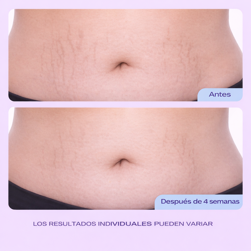 Go Pure - Crema para reafirmar y suavizar el vientre